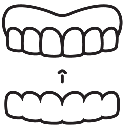 Dispositivos de avance mandibular (DAM) Dispositivos de avance mandibular (DAM)